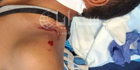 صور تقشعر لها الأبدان .. طفل يتعرض لهجوم من كلاب ضالة أمام طوارئ مستشفى البادية الشمالية - بوابة اخر ساعة